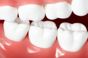 分光测色仪检测牙龈颜色差异对口腔健康的影响