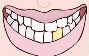 便携式色差仪在牙齿的美白和修复中的应用,你了解多少?